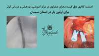 برای اولین بار در استان سمنان استنت گذاری دبل کیسه مجرای صفراوی در مرکز آموزشی، پژوهشی و درمانی کوثر انجام شد.